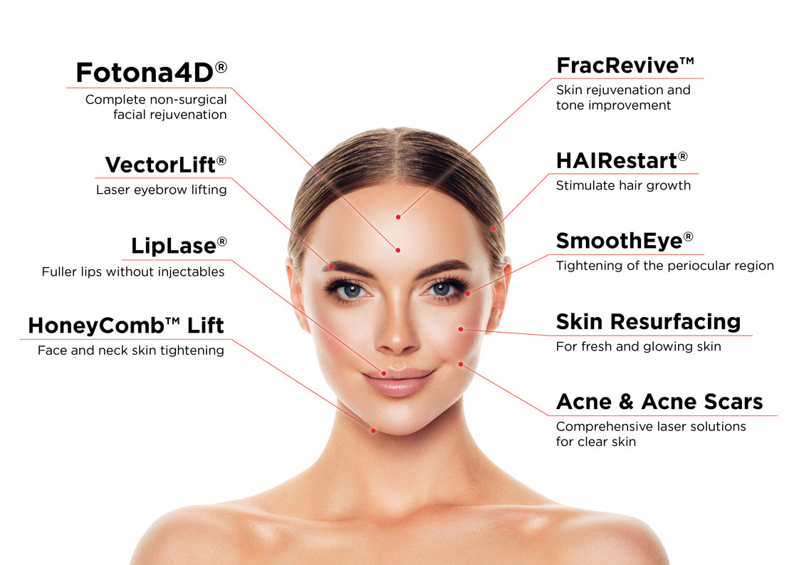 Fotona 4D diagram showing treatment areas: Fotona4D, VectorLift, LipLase, HoneyComb Lift, FracRevive, HAIRestart, SmoothEye, Skin Resurfacing, and Acne & Acne Scars