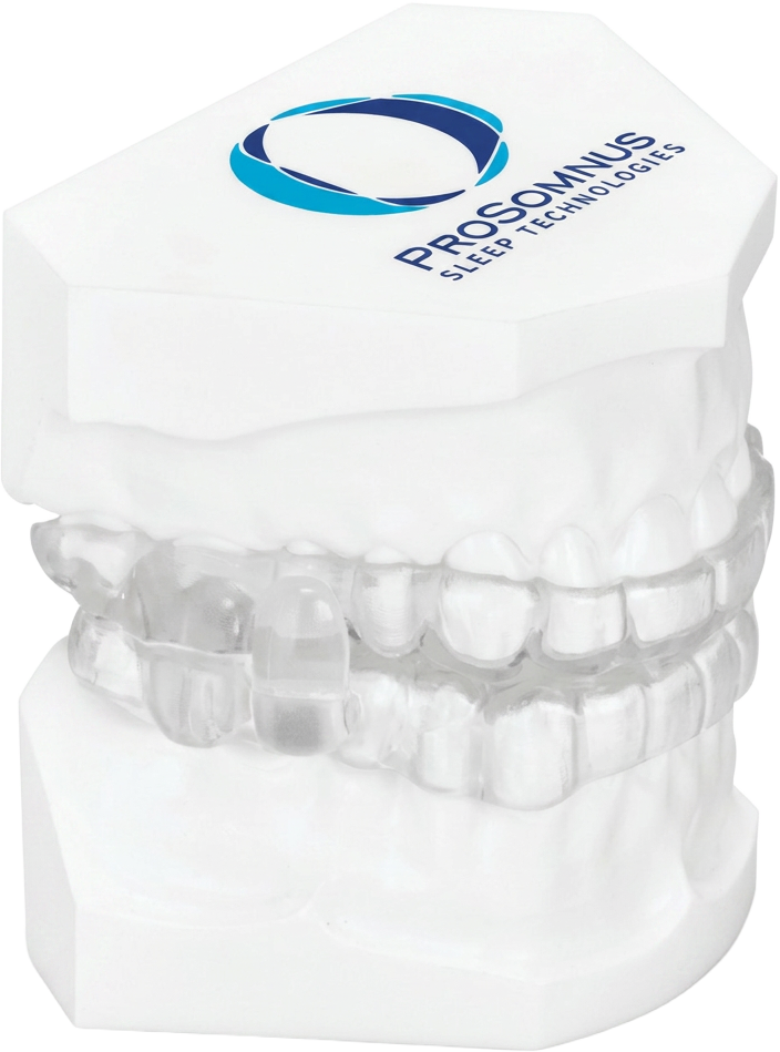 Custom ProSomnus oral sleep appliance shown on a dental model